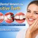 Dental veneers for sensitive teeth
